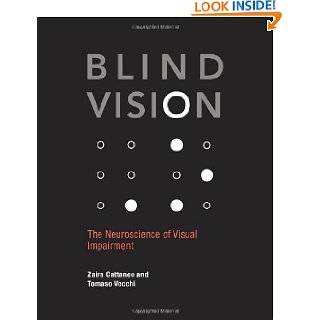  kindle for vision impaired