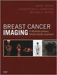 Breast Cancer Imaging A Multidisciplinary, Multimodality Approach 