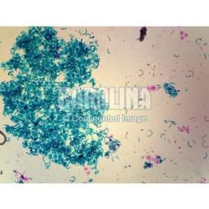  Water Bloom (Wasserbluthe), w.m. Microscope Slide 
