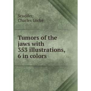 Tumors of the jaws with 353 illustrations, 6 in colors Charles Locke 