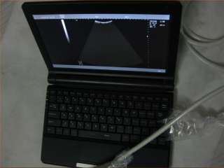   Portable Notebook Laptop Ultrasound machine Scanner system Digital