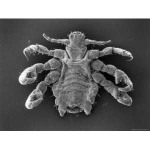  Scanning Electron Microscopic View of a Crab Louse Premium 